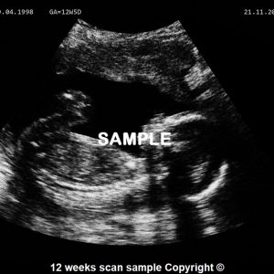 fake baby scan 12 weeks