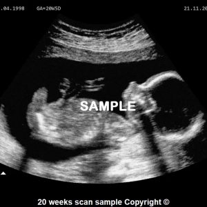 fake baby scan 20 weeks