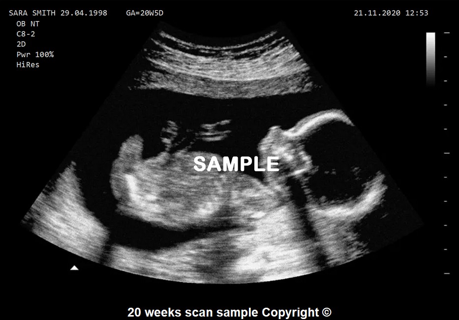 PRANK Joke Baby Scan Fake Ultrasound Pregnancy Custom ANY WEEK Personalised 