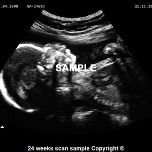 fake baby scan 24 weeks