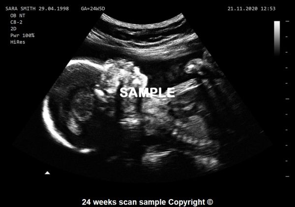 fake baby scan 24 weeks