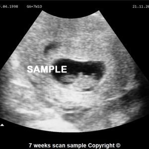 fake baby scan 7 weeks