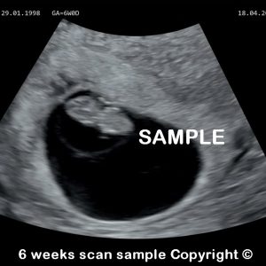 fake baby scan 6 weeks