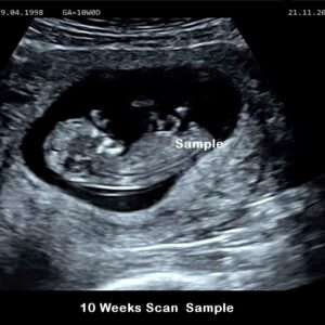 fake baby scan 10 weeks