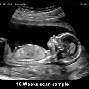 fake baby scan 16 weeks