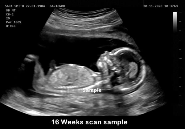 fake baby scan 16 weeks