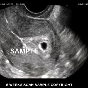 fake baby scan 5 weeks