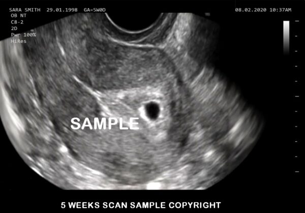 fake baby scan 5 weeks