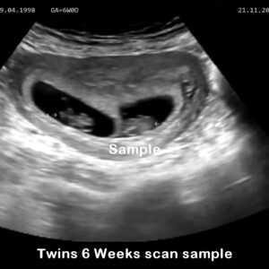 fake baby scan twins 6 weeks