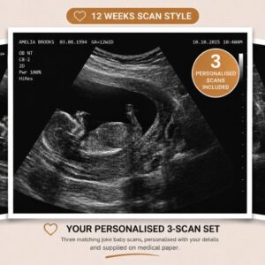 Joke Baby Scan 3 Pack Personalised Ultrasound Pictures on Medical Paper